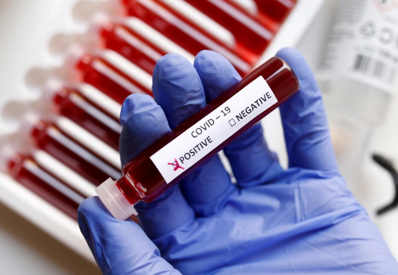 42 случая заболевания коронавирусом выявлено в Королёве за сутки